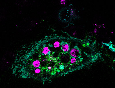 A healthy cell that has ingested dying cells.