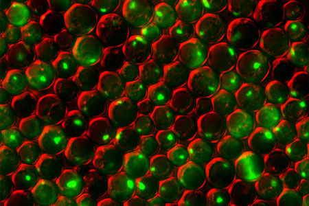 Yeast cells deficient in zinc and the Tsa1 protein have protein tangles. Credit: Colin MacDiarmid and David Eide, University of Wisconsin-Madison.