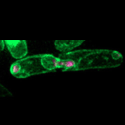 Stained yeast cell showing damaged DNA